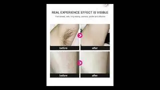 Laser Diode 808nm Permanent Hair Removal Machine Device Small Desk Table Top NIW Surgicals