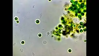 Potential Filasteria, Kraken, or other Cercozoa - Pt. 4