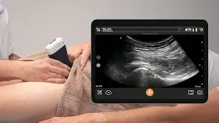 Ультразвуковое исследование тазобедренного сустава