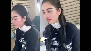 Tai Vểnh - m&ocirc;i t&acirc;yXinh xuất sắc Angel beauty clinic