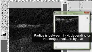 018 Noise Reduce Median Filter Microscope Images