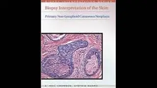 Biopsy Interpretation of the Skin Primary Non Lymphoid Neoplasms of the Skin Har/Psc