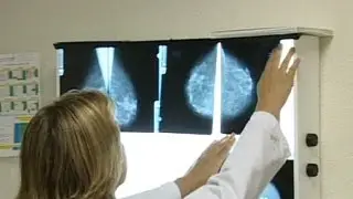 Britain offers preventive drug for breast cancer