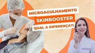 Microagulhamento e Skinbooster: Qual a diferen&ccedil;a?  Dra Giselle Barban
