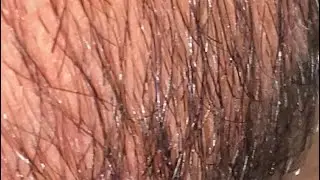 Extreme Hair Transformation! | Damaged Hair to Silky Smooth