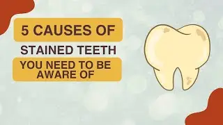 5 Causes of Stained Teeth You Need to Be Aware Of | Dental House MI