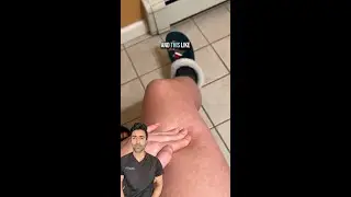 Why Your Skin Turns Pale When You Press on It