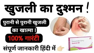 Ketoconazole 200mg ।। खुजली खत्म कैसे करें ।। Itching Problem ।। Faizu Ki Tips