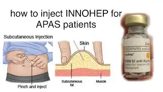 How to inject INNOHEP for APAS/ PAANO MAG INJECT NG INNOHEP/ HEPARIN/TINZAPARIN SODIUM w/ nurse Gen