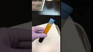 PRP (Platelet Rich Plasma) in the Tube