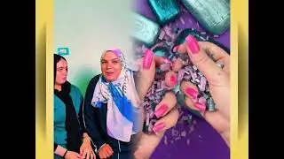 #الطفل الاعمى المعجزه #محضوره_من_الاكسبلور_والمشاهدات #علاوي_مارتن #اكسبلور 15_w