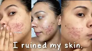 Я испортила свою кожу этим бьюти-хаком... #шорты #уходзакожей