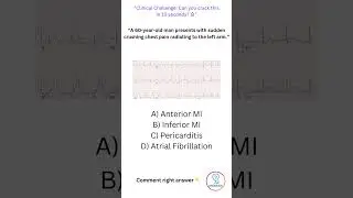 ❤️ ECG Quiz: Can You Spot an Inferior MI? | MedQuiz