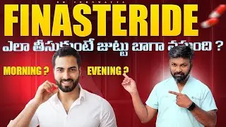 #AskDrJohnWatts | FINASTERIDE ఎలా తీసుకుంటే జుట్టు బాగా వస్తుంది ? | Hair Specialist Explains