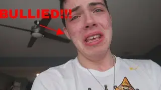 Top 5 faze members that was bullied