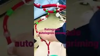 Retrograde autologous Priming of CPB circuit