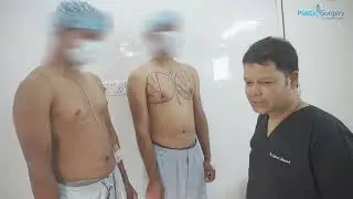 Chest fat removal | male breast reduction | Gynecomastia surgery Bangladesh | Dr Iqbal Ahmed