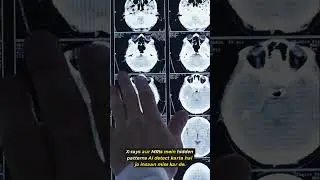 AI in Healthcare  Miracle or Risk