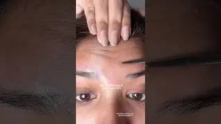 How BOTOX should look in your 20s?👀💉#skin1004 #retinol #wrinkles #review #youtubeshorts #fyp #skin
