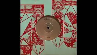 Causa - Hiss