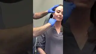 Sculptra for facial rejuvenation with Dr. Janowski