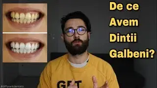 DE CE AVEM DINTII GALBENI? / Dentistry Hub