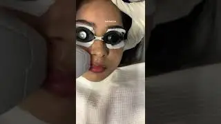 Laser Hair Removal I SHYAMOSA Skin Hair Clinic #Shorts