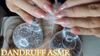 ASMR DANDRUFF || ASMR KETOMBE ||  WIG SCRACTH AND ICE GLOBE