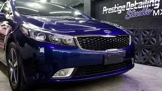 Detailing Kia Forte