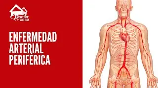 ¿Qué es la enfermedad arterial periférica?