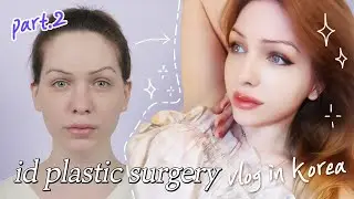 Danielle's Story part 2 Facial Feminization Surgery in Korea