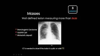 3  Imaging of focal lung lesions    Prof  Mamdouh Mahfouz HD