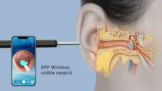 NE3 Wireless Earpick