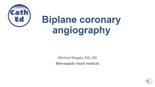 How to perform biplane coronary angiography?
