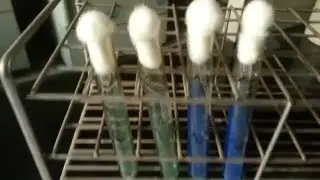 Citrate Utilization Test for bacteria