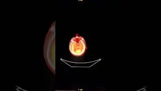 RadioActive ☢️ Photographer #PETCT #NuclearMedicine #FluoroDeoxyGlucose