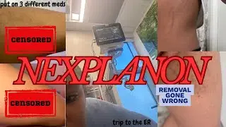 Birth Control Removal Gone WRONG! 💉