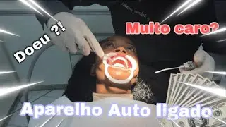 COLOQUEI APARELHO AUTO LIGADO + Minha primeira 24 hrs com ele 😭