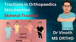 Traction in Orthopaedics| Skin traction| Skeletal traction|Russell's traction| Bohler Braun Splint