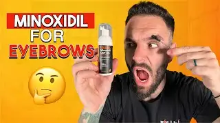 Can Minoxidil Help YOU Grow Your Eyebrows?!