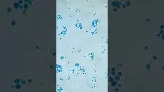 Yeasts and budding yeasts in LPCB at a mag. of 1600X #shorts