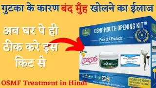OSMF Mouth opening treatment at home kit | OSMF Treatment in hindi | oral submucous fibrosis | OSMF