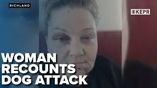 Richland woman recounts dog attack, expresses gratitude for community support
