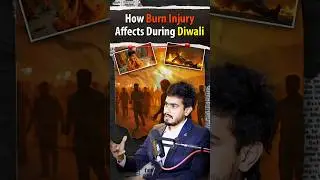 How Burn Injuries🔥Affect Your Health During Diwali | Common Injuries & How They Affect You.