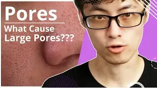 What Cause Large Pores? | Why Do Pores Get So Big? | Cause of Acne & Pimples !! Skin Care Tips #1