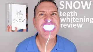 SNOW Teeth Whitening Review & Unboxing 2020 - Does Snow really work?