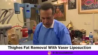 Contoured Thighs: Vaser Liposuction - The Slimming Secret! #fatremoval #lasertreatment #liposuction