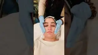 European / wow peel - a patients testimonial