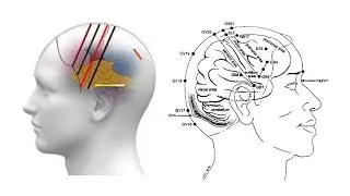 THE CEREBRAL CORTEX THEORY IN SCALP ACUPUNCTURE