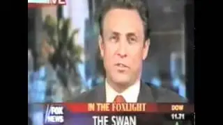 Fox News: Life After The Swan- healing after Plastic Surgery